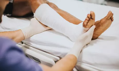 Dr. Alfredo Ortega Quiroz, Cirujano Ortopedista Traumatólogo, Alta Especialidad en Cirugía de Columna Vertebral