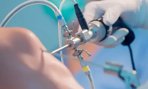 Dr. Alfredo Ortega Quiroz, Cirujano Ortopedista Traumatólogo, Alta Especialidad en Cirugía de Columna Vertebral